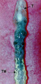 Túbulos de Malpighi